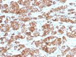 LH-beta (Luteinizing Hormone-beta) Antibody in Immunohistochemistry (Paraffin) (IHC (P))