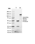 LH-beta (Luteinizing Hormone-beta) Antibody in SDS-PAGE (SDS-PAGE)