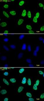 Histone H3K18ac Antibody in Immunocytochemistry (ICC/IF)