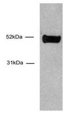 HNF-3 alpha / FOXA1 Antibody in Western Blot (WB)