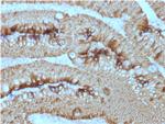 Ep-CAM/CD326 (Extracellular Domain) (Epithelial Marker) Antibody in Immunohistochemistry (Paraffin) (IHC (P))