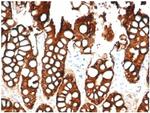 Ep-CAM/CD326 (Extracellular Domain) (Epithelial Marker) Antibody in Immunohistochemistry (Paraffin) (IHC (P))