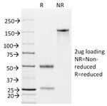 Ep-CAM/CD326 Antibody in SDS-PAGE (SDS-PAGE)