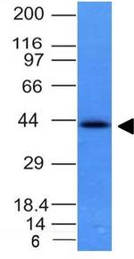 Ep-CAM/CD326 Antibody in Western Blot (WB)