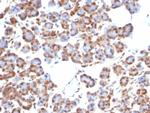 SMAD4/DPC4 (Pancreatic Adenocarcinoma Marker/Tumor Suppressor) Antibody in Immunohistochemistry (Paraffin) (IHC (P))