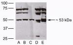 MINA53 Antibody in Western Blot (WB)