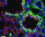 Claudin 10 Antibody in Immunohistochemistry (IHC)