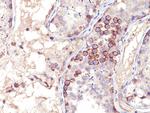 MAGE-1 (Target for Cancer Immunotherapy) Antibody in Immunohistochemistry (Paraffin) (IHC (P))