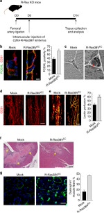 PODXL Antibody in Immunohistochemistry (IHC)