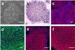 Nanog Antibody in Immunocytochemistry, Immunohistochemistry (ICC/IF, IHC)