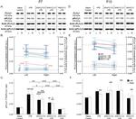 PLCG1 Antibody in Western Blot (WB)