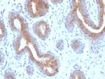 Mammaglobin (SCGB2A2) (Breast Cancer Marker) Antibody in Immunohistochemistry (Paraffin) (IHC (P))