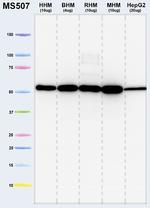 ATP5A1 Antibody in Western Blot (WB)