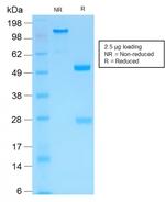 MMP3 (Marker of Metastasis and Rheumatoid Arthritis) Antibody in SDS-PAGE (SDS-PAGE)