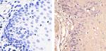 Galectin 1 Antibody in Immunohistochemistry (Paraffin) (IHC (P))