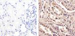 Galectin 1 Antibody in Immunohistochemistry (Paraffin) (IHC (P))