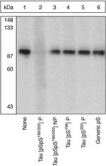 Phospho-Tau (Ser199, Ser202) Antibody