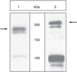 VEGF Receptor 2 Antibody in Western Blot (WB)