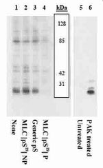 Phospho-MYLK (Ser19) Antibody in Western Blot (WB)