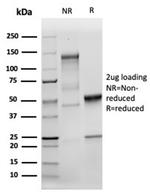 MSH2 Antibody in SDS-PAGE (SDS-PAGE)