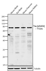 Phospho-Tau (Ser404) Polyclonal Antibody (44-758G)
