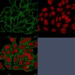 Moesin Antibody in Immunocytochemistry (ICC/IF)