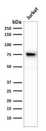 Moesin Antibody in Western Blot (WB)