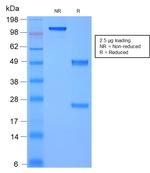 Moesin Antibody in SDS-PAGE (SDS-PAGE)