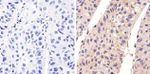 Phospho-EGFR (Tyr1173) Antibody in Immunohistochemistry (Paraffin) (IHC (P))