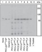 Phospho-PKC gamma (Thr514) Antibody