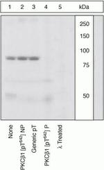 Phospho-PKC beta-1 (Thr642) Antibody in Western Blot (WB)