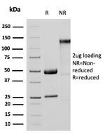 MTAP Antibody in SDS-PAGE (SDS-PAGE)
