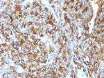 MUC1/CA15-3/EMA/CD227 (Epithelial Marker) Antibody in Immunohistochemistry (Paraffin) (IHC (P))