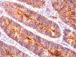 MUC1/CA15-3/EMA/CD227 (Epithelial Marker) Antibody in Immunohistochemistry (Paraffin) (IHC (P))