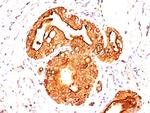 MUC1/CA15-3/EMA/CD227 (Epithelial Marker) Antibody in Immunohistochemistry (Paraffin) (IHC (P))