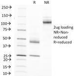 MUC1/CA15-3/EMA/CD227 (Epithelial Marker) Antibody in SDS-PAGE (SDS-PAGE)