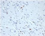 Myogenin/Myf-4 (Skeletal Muscle Marker) Antibody in Immunohistochemistry (Paraffin) (IHC (P))