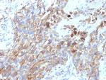 CD56/NCAM1/NKH1 Antibody in Immunohistochemistry (Paraffin) (IHC (P))