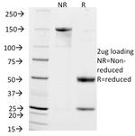 CD56/NCAM1/NKH1 Antibody in SDS-PAGE (SDS-PAGE)