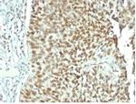 Nucleolin Antibody in Immunohistochemistry (Paraffin) (IHC (P))