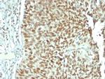 Nucleolin Antibody in Immunohistochemistry (Paraffin) (IHC (P))