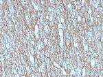 Neurofilament Antibody in Immunohistochemistry (Paraffin) (IHC (P))