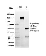 NFIA/NF1A (Nuclear Factor 1A) (Transcription Factor) Antibody in SDS-PAGE (SDS-PAGE)
