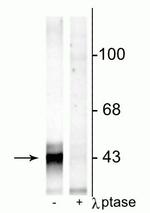 Phospho-Connexin 43 (Ser368) Antibody in Western Blot (WB)