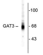 SLC6A11 Antibody in Western Blot (WB)