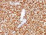 NKX2.2 (Neuroendocrine and Ewing'sarcoma Marker) Antibody in Immunohistochemistry (Paraffin) (IHC (P))