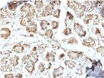 NME2/nm23-H2/NDPK-B (Suppressor of Metastasis) Antibody in Immunohistochemistry (Paraffin) (IHC (P))