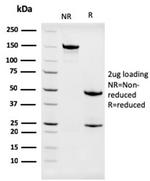 Nucleophosmin Antibody in SDS-PAGE (SDS-PAGE)