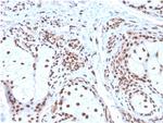 Nucleophosmin Antibody in Immunohistochemistry (Paraffin) (IHC (P))