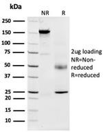 Nucleophosmin (Acute Myeloid Leukemia Marker) Antibody in SDS-PAGE (SDS-PAGE)